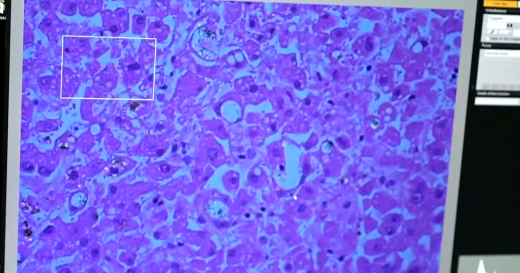 How nanoplastics may be impacting our long-term health